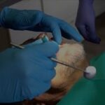 Top Pediatric Dentist in Newmarket – Expert Care for Your Child