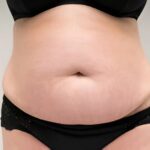 Scar Camouflage Clinic Dubai – Restore Confidence with Expert Treatments