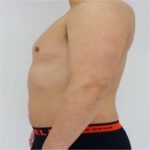 Mounjaro Johor Bahru: Safe, Trusted Injections Near You