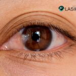 Surgery for Pterygium: Expert Care and Modern Techniques