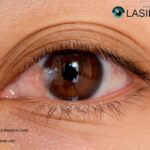 Pterygium Eyedrops | Pterygiumhouston.com