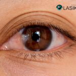 Pterygium Remedy: Gentle Relief and Practical Tips