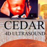 Non-diagnostic 3D/4D Ultrasound Perth – Safe, Bonding Sessions