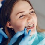 Find Top Dental Veneers Near Me for a Radiant Smile